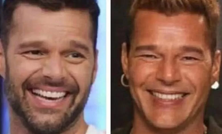 Ricky Martin Cambios En Su Rostro Que Le Paso 780x470