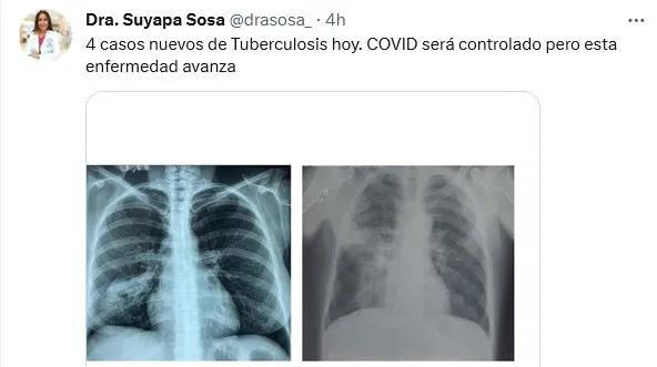 Screenshot 2023-01-31 at 17-07-47 (6) Dra. Suyapa Sosa (@drasosa_) _ Twitter