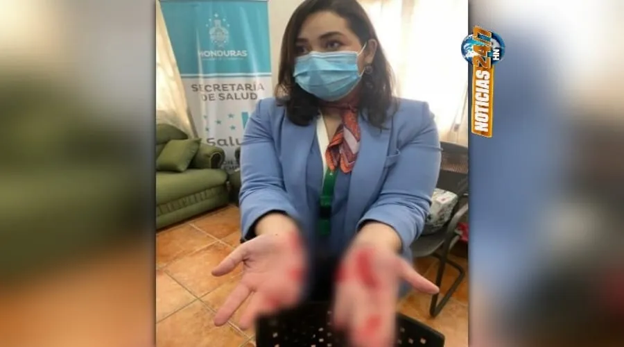 Video: Virus de la violencia infecta al personal administrativo de la Región Sur Sanitaria