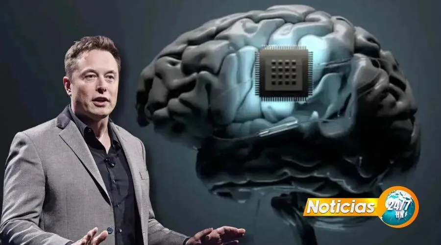 Elon Musk Chips Cerebro