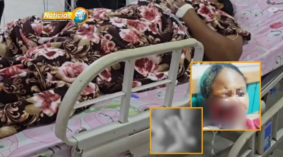 Revelan Que Quinceanera Que Recibio Un Balazo En El Rostro Esta Embarazada
