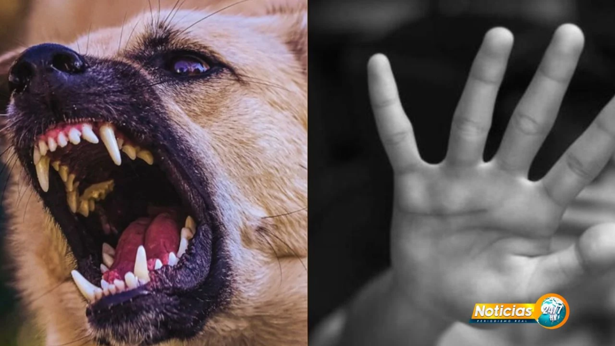 Nino Sufre Mordedura En Sus Genitales Por Parte De Un Perro En La Zona Sur
